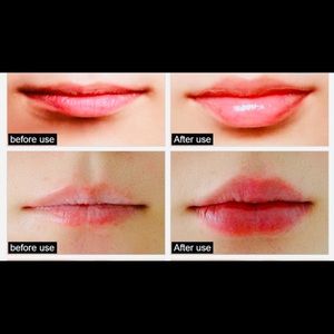 LIP PLUMPER